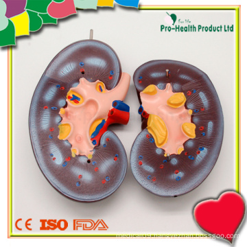 Medical Anatomy Human Kidney Model